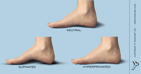 https://mass4d.com/blogs/clinicians-blog/medial-arch-height